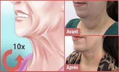 Comment vous débarrasser du double menton