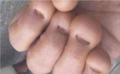 Se Ronger les Ongles Peut Vous Coûter la Vie : L'Histoire Tragique de John Gardener